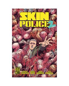 Skin Police 2 #1